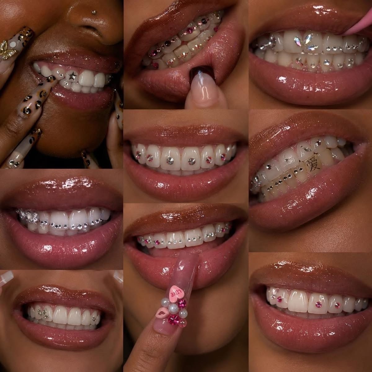 Tooth gems